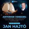 OHI-S Anterior veneers: Digital manufacturing protocols for functional and aesthetic restorations OHI-S Anterior veneers: Digital manufacturing protocols for functional and aesthetic restorations