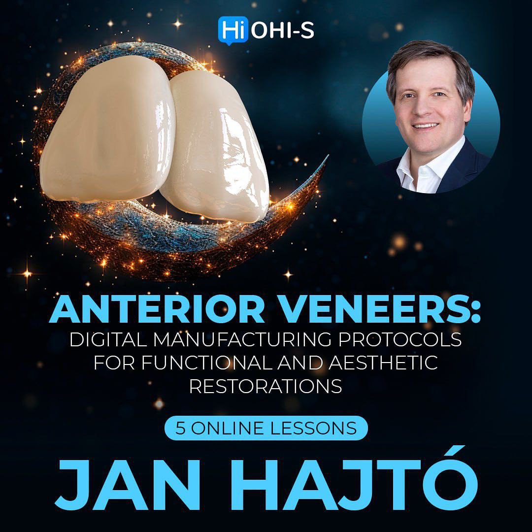 OHI-S Anterior veneers: Digital manufacturing protocols for functional and aesthetic restorations OHI-S Anterior veneers: Digital manufacturing protocols for functional and aesthetic restorations