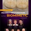 Indirect Restoration in the Biomimetic Concept Indirect Restoration in the Biomimetic Concept