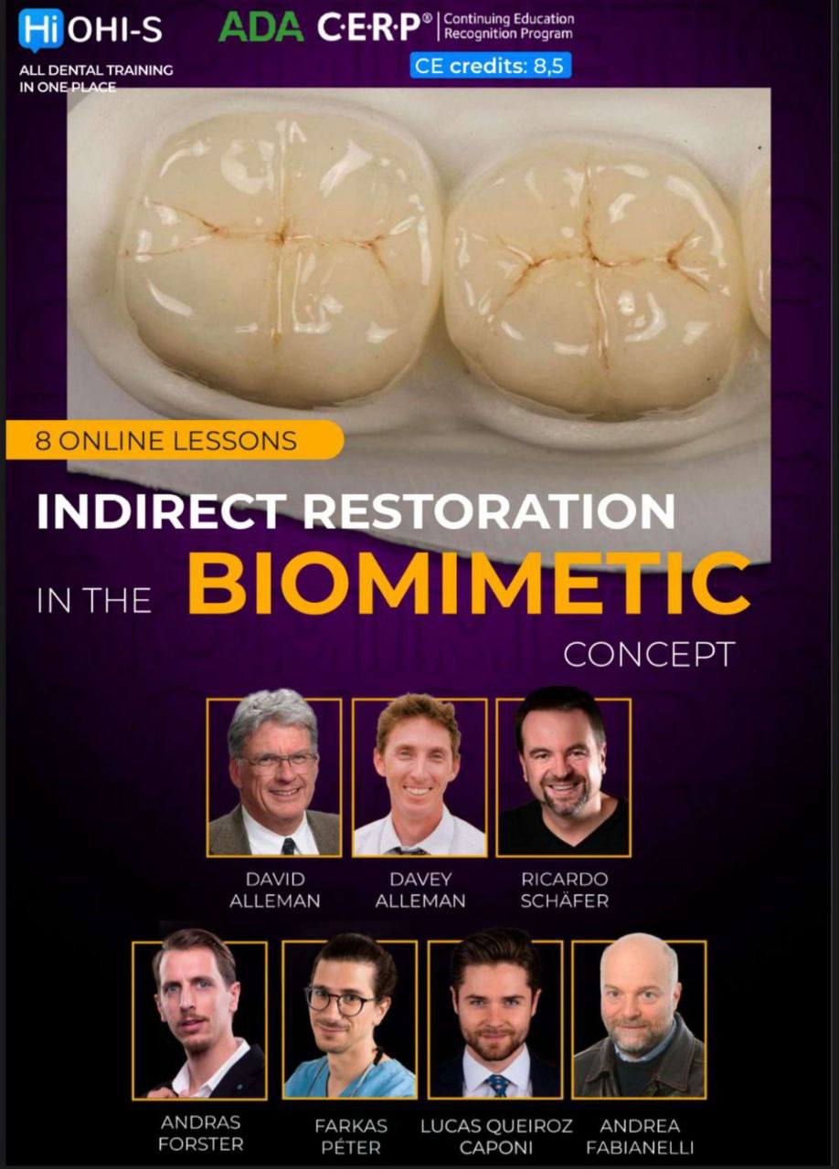 Indirect Restoration in the Biomimetic Concept Indirect Restoration in the Biomimetic Concept