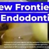 OHI-S New Frontiers in Endodontics Guide to Predictable Practice OHI-S New Frontiers in Endodontics