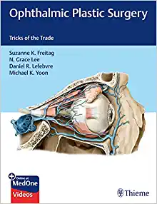 Ophthalmic Plastic Surgery Tricks Of The Trade EPUB