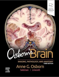 Osborns Brain ImagingPathology and Anatomy 3e 2024 Original PDF