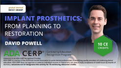 Osteocom Implant Prosthetics