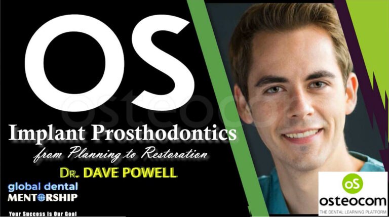 Osteocom Implant Prosthodontics, from Planning to Restoration – David Powell Osteocom Implant Prosthodontics, from Planning to Restoration – David Powell