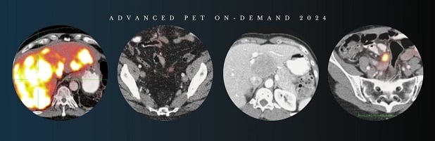 PET On-Demand 2024 – CMEScience (Videos) PET On Demand 2024 – CMEScience Videos
