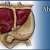 Pegasus Lectures Complete Abdomen Review eCourse