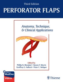 Perforator Flaps Anatomy Technique Clinical Applications 3rd Edition Original PDF From PublisherVideos