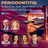Periodontitis – Surgical and Non-Surgical Treatment Methods Periodontitis – Surgical and Non-Surgical Treatment Methods