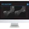 Plexus and Peripheral Nerve Imaging 2024
