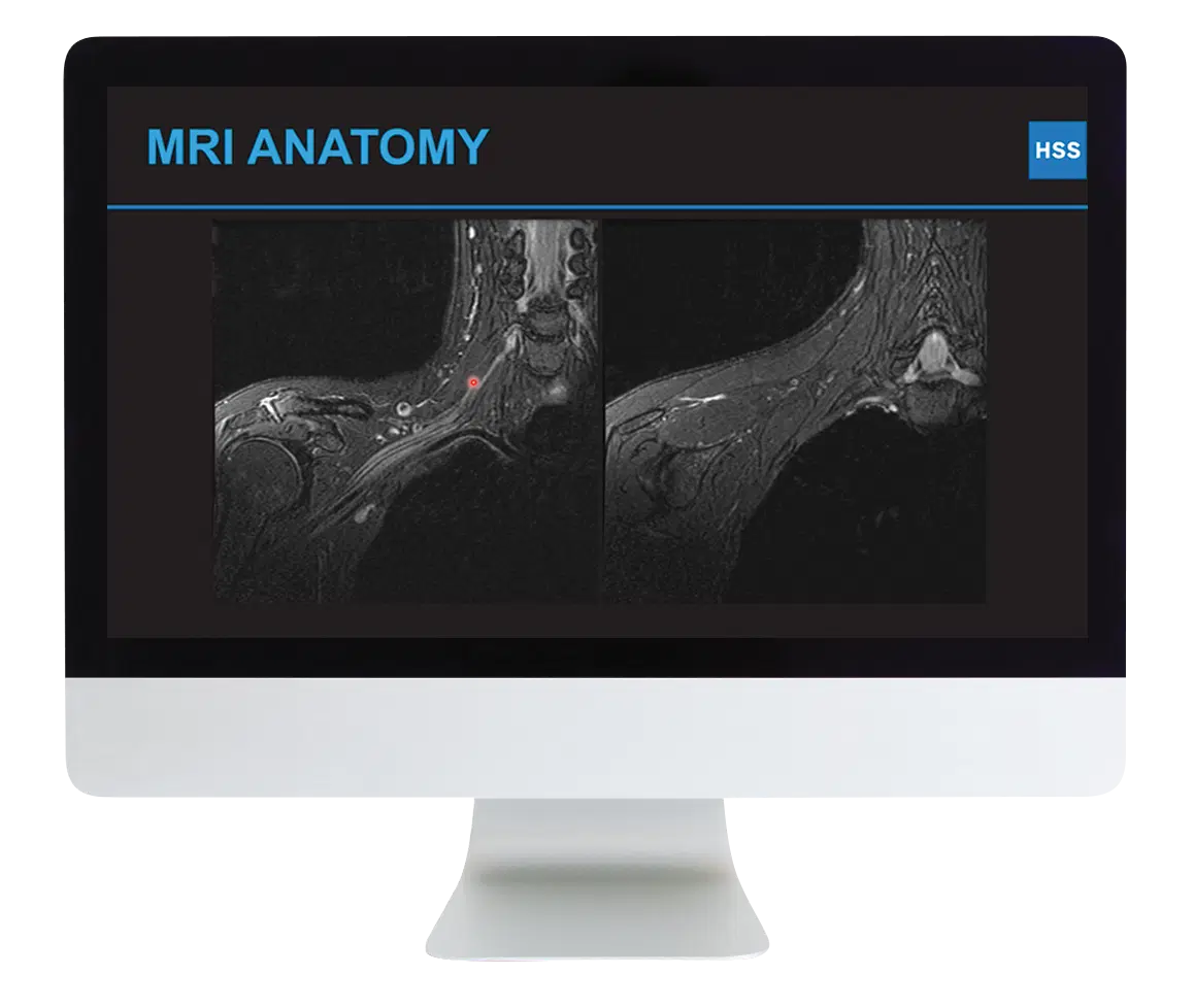 Plexus and Peripheral Nerve Imaging 2024 Plexus and Peripheral Nerve Imaging 2024