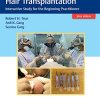 Practical Guide To Hair Transplantation: Interactive Study For The Beginning Practitioner (Original PDF From Publisher+Videos) Practical Guide To Hair Transplantation Interactive Study For The Beginning Practitioner Original PDF From PublisherVideos