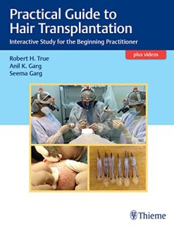 Practical Guide To Hair Transplantation Interactive Study For The Beginning Practitioner Original PDF From PublisherVideos