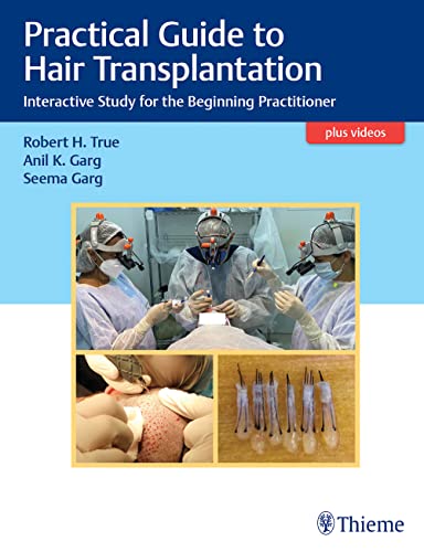 Practical Guide To Hair Transplantation: Interactive Study For The Beginning Practitioner (Original PDF From Publisher+Videos) Practical Guide To Hair Transplantation Interactive Study For The Beginning Practitioner Original PDF From PublisherVideos