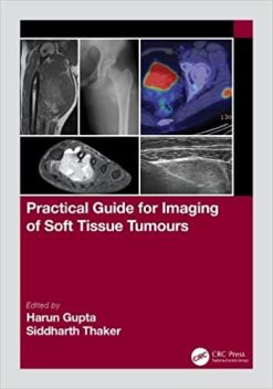 Practical Guide for Imaging of Soft Tissue Tumours Original PDF from Publisher