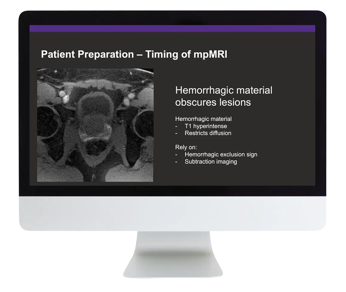 Prostate MR Case Review 2024 Prostate MR Case Review 2024