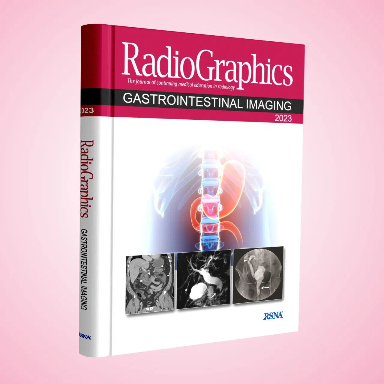 Radiographics Gastrointestinal Imaging 2023 Radiographics Gastrointestinal Imaging 2023
