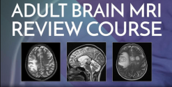 Radiopaedia ADULT BRAIN MRI REVIEW COURSE