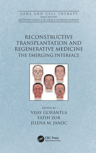 Reconstructive Transplantation And Regenerative Medicine: The Emerging Interface (Gene And Cell Therapy) (Original PDF From Publisher) Reconstructive Transplantation And Regenerative Medicine: The Emerging Interface (Gene And Cell Therapy) (Original PDF From Publisher)