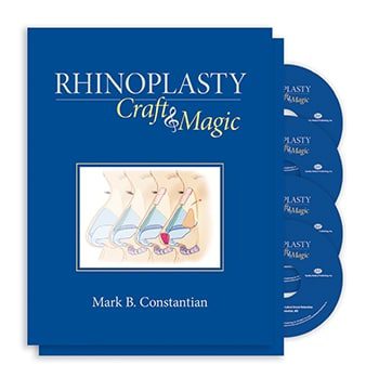 Rhinoplasty: Craft and Magic Rhinoplasty Craft and Magic
