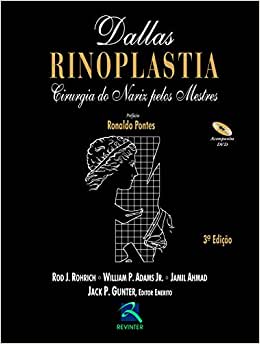 Rinoplastia: Cirurgia Do Nariz Pelos Mestres, 3rd Edition (Original PDF From Publisher) Rinoplastia Cirurgia Do Nariz Pelos Mestres 3rd Edition Original PDF From Publisher