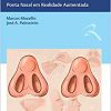 Rinoplastia Ponta Nasal Em Realidade Aumentada Original PDF From Publisher