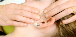 TMJ Extremity Proficiency Product 2023