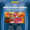 The Direct Anterior Approach To Hip Reconstruction 2nd Edition EPUB