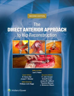 The Direct Anterior Approach To Hip Reconstruction 2nd Edition EPUB