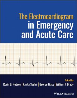The Electrocardiogram in Emergency and Acute Care 2023
