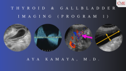 Thyroid Gallbladder Imaging Program 1 – Aya Kamaya M.D. CMEScience Videos