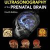 Timors Ultrasonography of the Prenatal Brain 4th edition Original PDF from Publisher