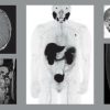 UCSF Radiology Annual Review – 2024 UCSF Radiology Annual Review – 2024