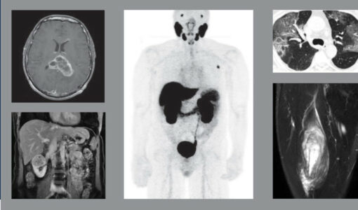 UCSF Radiology Annual Review – 2024 UCSF Radiology Annual Review – 2024