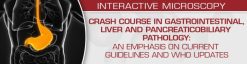 USCAP Crash Course in Gastrointestinal, Liver and Pancreaticobiliary Pathology: An Emphasis on Current Guidelines and WHO Updates 2022 (CME VIDEOS)