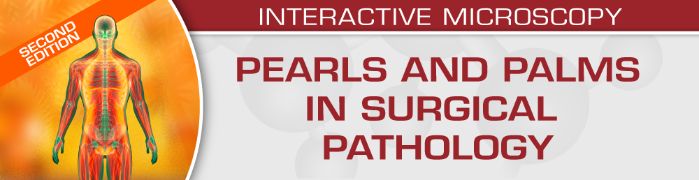 USCAP Second Edition: Pearls and Palms in Surgical Pathology 2023 USCAP Second Edition Pearls and Palms in Surgical Pathology 2023