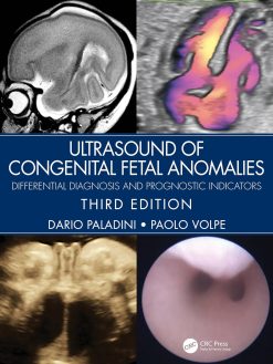 Ultrasound Of Congenital Fetal Anomalies Differential Diagnosis And Prognostic Indicators 3rd Edition Original PDF From Publisher