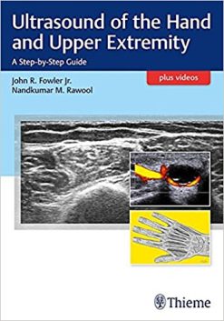 Ultrasound Of The Hand And Upper Extremity A Step By Step Guide Original PDF From Publisher Videos
