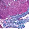 Current Topics In Gastrointestinal And Liver Pathology 2023 (John Hopkins) (Videos) Current Topics In Gastrointestinal And Liver Pathology 2023 (John Hopkins) (Videos)