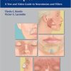 VIDEO Cosmetic Injection Techniques Neurotoxins and Fillers VIDEO Cosmetic Injection Techniques Neurotoxins and Fillers