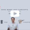 ZBLC Immediate MasterClass (Zero Bone Loss Concepts) ZBLC Immediate MasterClass (Zero Bone Loss Concepts)