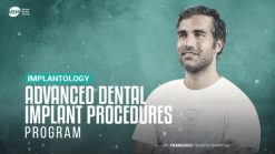 advanced dental implant procedures 510x287 1