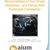 AIUM Prenatal Ultrasound Abnormalities of the Chest, Abdomen, and Pelvis With Postnatal Correlation aium prenatal ultrasound abnormalities of the chest abdomen and pelvis with postnatal correlation medical video courses 565698 720x