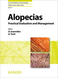 alopecias practical evaluation and management 1