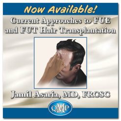 current approaches to fue and fut hair transplantation