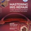 mastering iris repair
