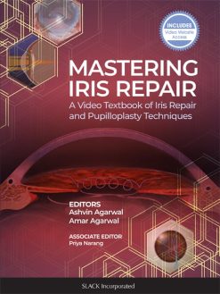 mastering iris repair