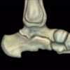 mri mastery series ankle 510x463 1