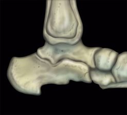 mri mastery series ankle 510x463 1