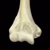 mri mastery series elbow 510x456 1